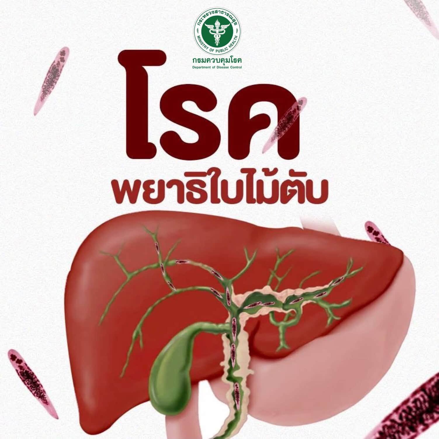 โรคพยาธิใบไม้ตับ (Opisthorchiasis)